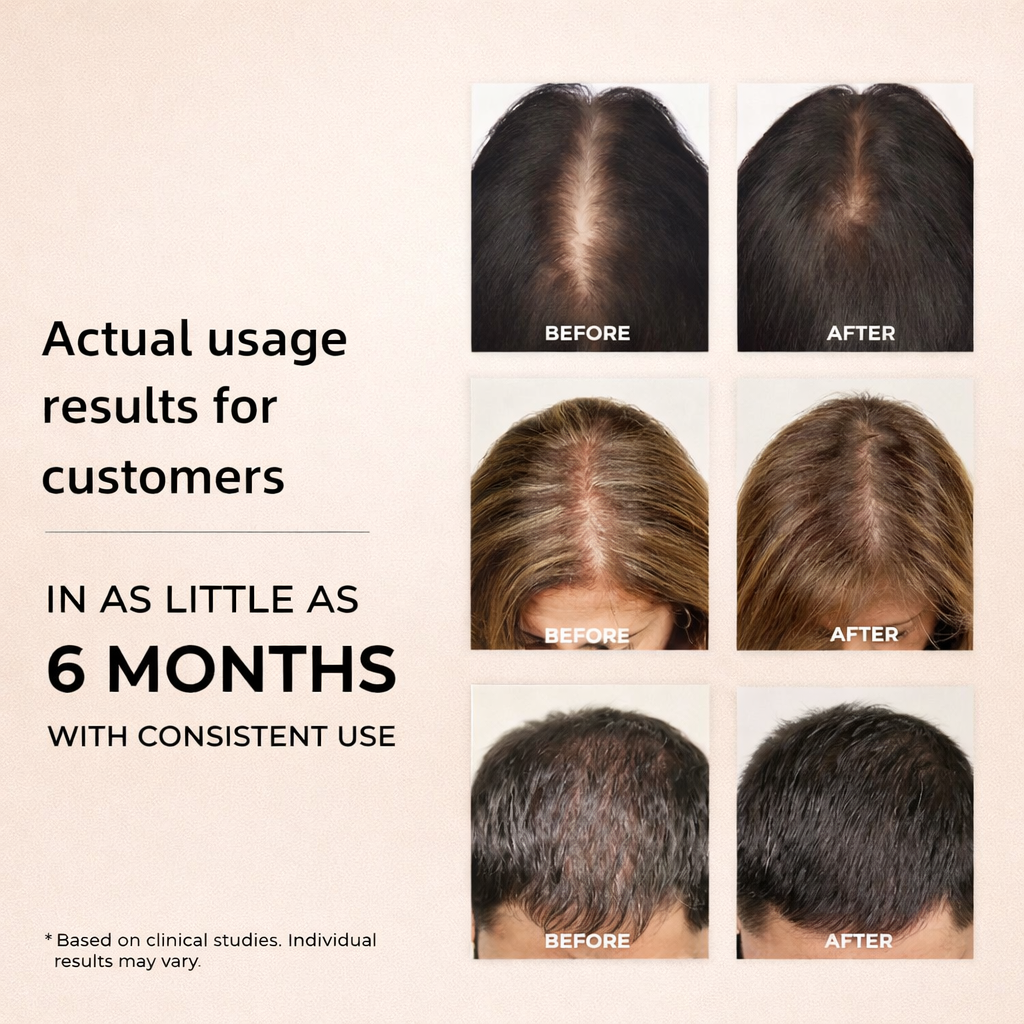 Regrow Thicker, Fuller Hair — At Home, Drug-Free