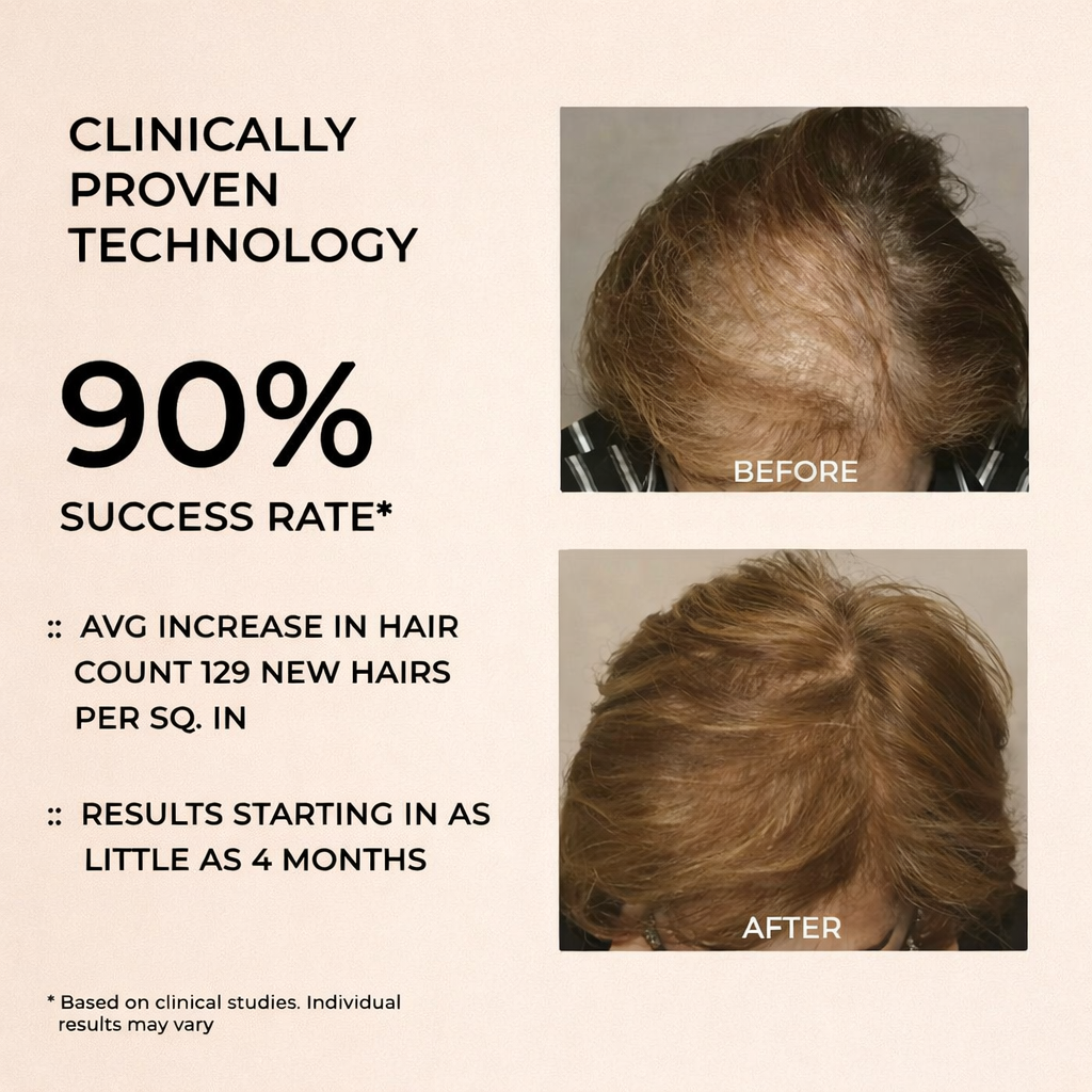 Regrow Thicker, Fuller Hair — At Home, Drug-Free